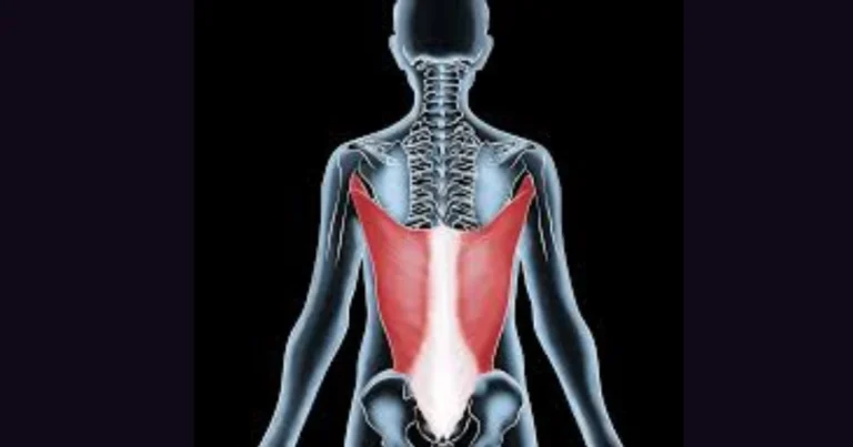 Pulled latissimus dorsi