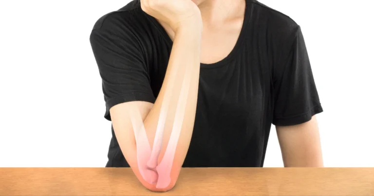 Hyperextended Elbow