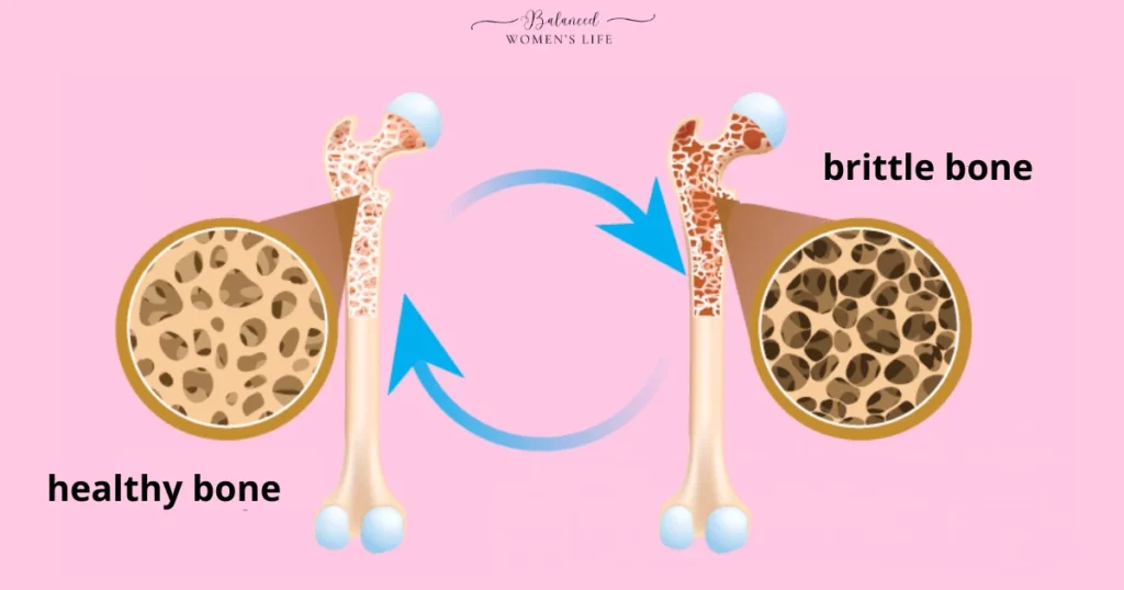 Osteoporosis Treatment